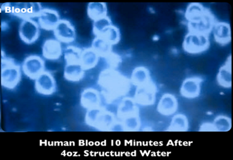 split image showing on the left side, irregular shaped cloudy blood cells before consuming structured water and on the right side, luminescent perfectly round blood cells 10 minutes after drinking the revitalized water.